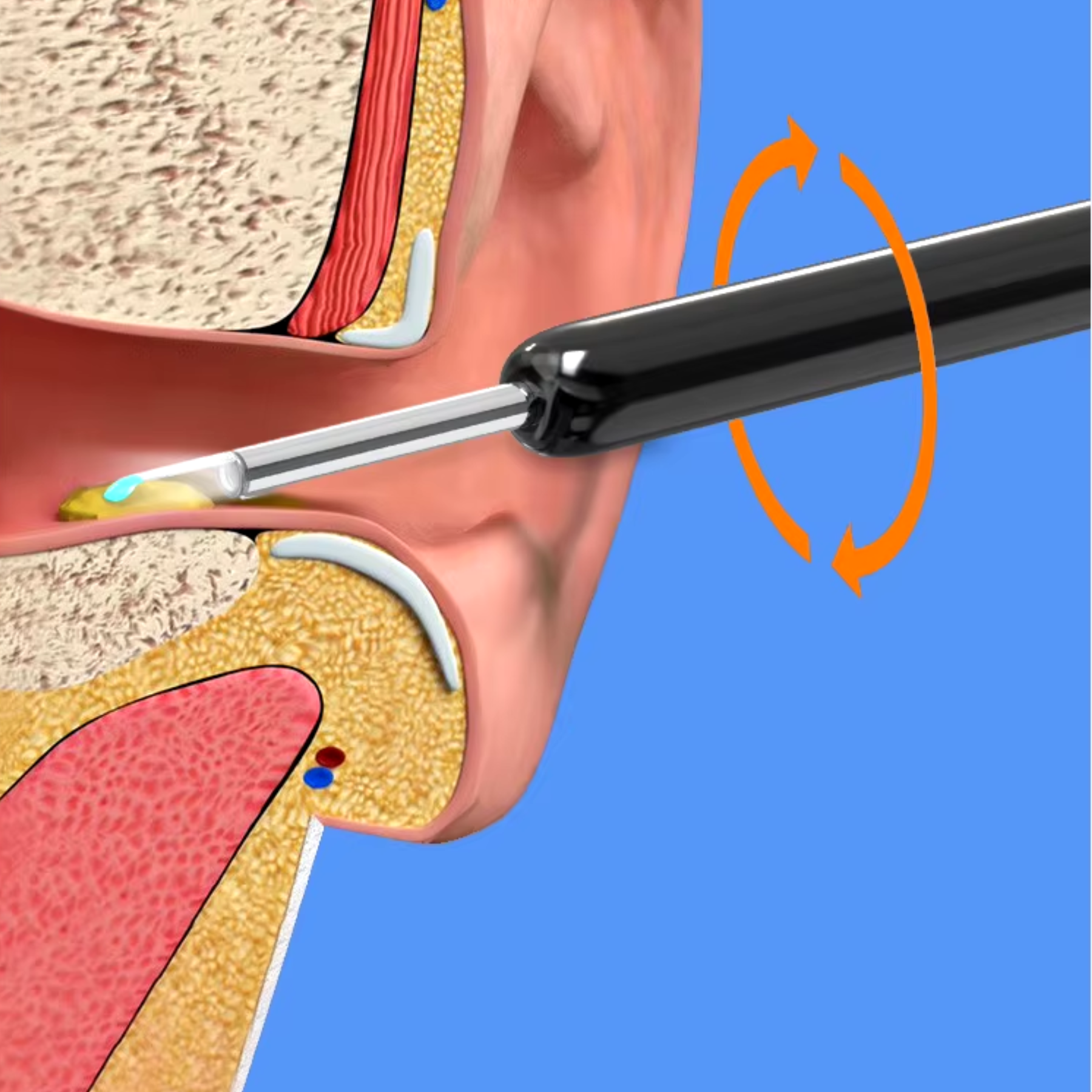 EarScope ™ - Otoscopio inalámbrico